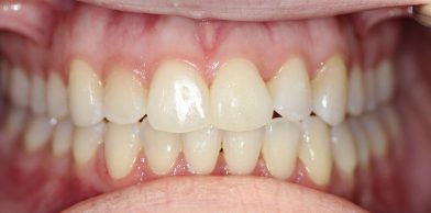 Midtown General & Cosmetic Dentistry after1 1