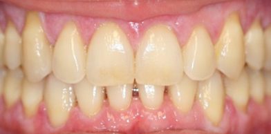 Midtown General & Cosmetic Dentistry after15