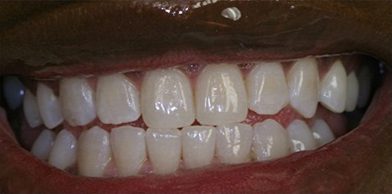 Midtown General & Cosmetic Dentistry after2