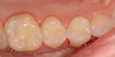 Midtown General & Cosmetic Dentistry after4