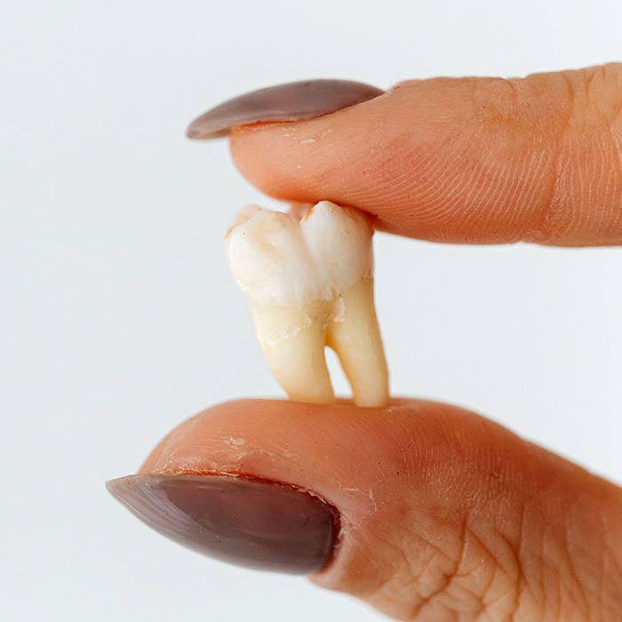 Midtown General & Cosmetic Dentistry baby teeth traditions 2023 700
